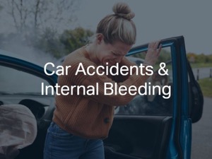 Car Accidents and Internal Bleeding