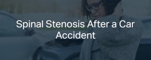 Spinal Stenosis After a Car Accident